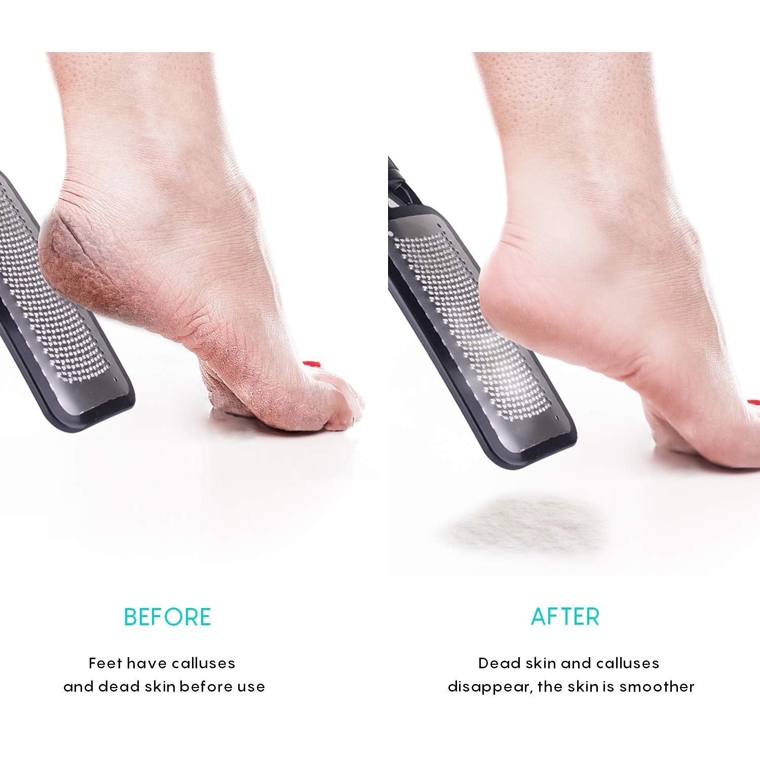 Foot Scrubber Pedicure Tools Rasp - 5 PCS KENED Foot File Callus Remover For Feet To Remove Hard Skin - 2 X Stainless Steel Black, 3 X Plastic Blue